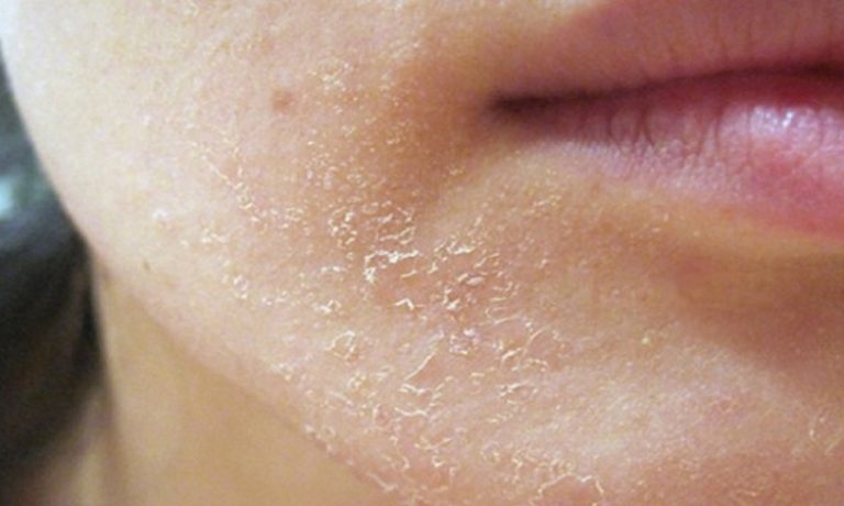 ویتامین‌های مناسب پوست و مو و ناخن