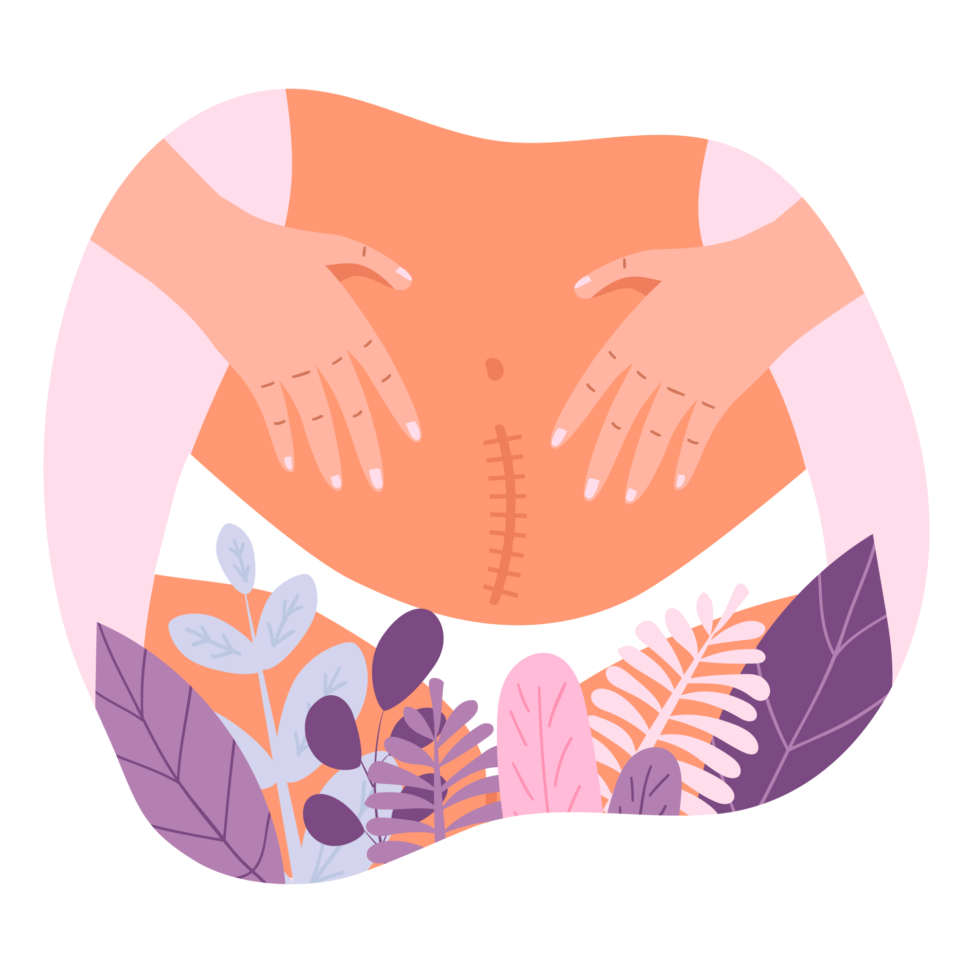 انواع بخیه در زایمان طبیعی و سزارین و دلایل ایجاد اسکار