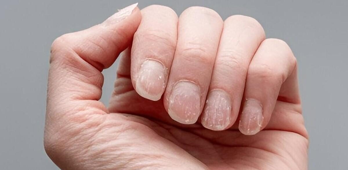 با ناخن‌هایتان این کار را نکنید!