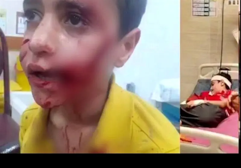 حمله سگ‌های ولگرد به کودک 11 ساله؛ امیرعلی جان خود را از دست داد