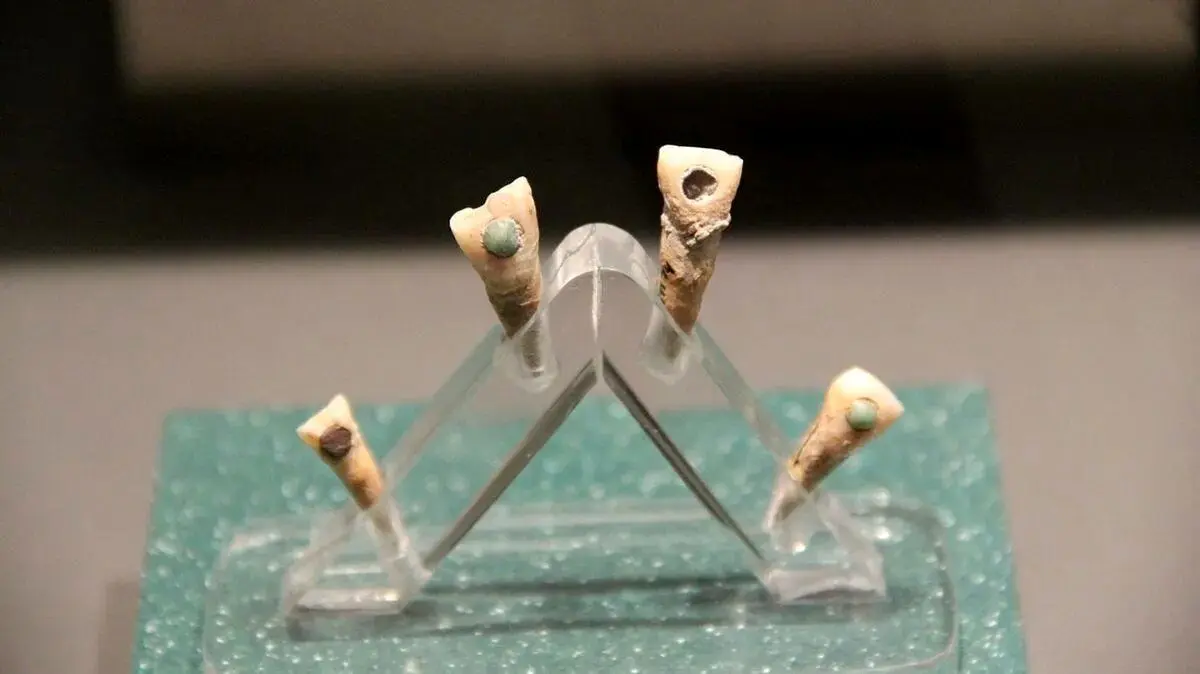 دندان های مرموز باستانی با نگین یشم! + تصاویر