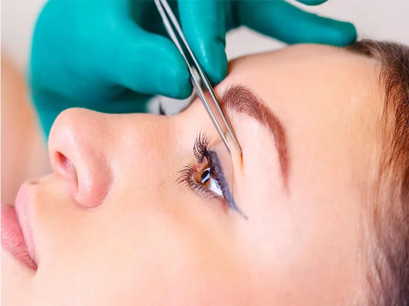 سیر تا پیاز عمل جراحی زیبایی پلک (بلفاروپلاستی)