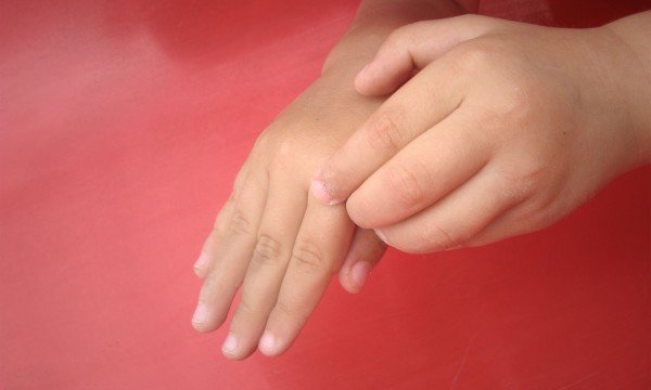 علت بی‌حسی و درد انگشتان چیست؟