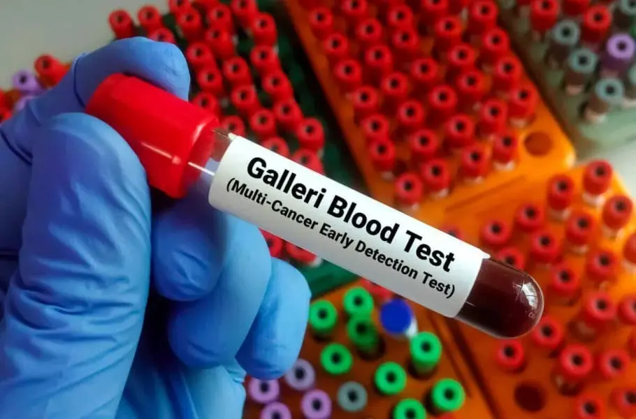 آزمایش خون Galleri؛ گامی نو در تشخیص سرطان‌های فاقد برنامه غربالگری