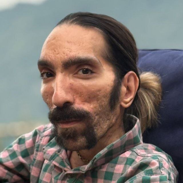 آقای رئیس جمهور چه خبر از مانیفست معلولان؟