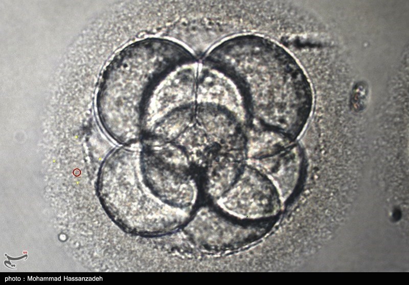 اخبار پزشکی|نوآوری در درمان ناباروری مردان با ویرایش ژنی/ کشف 1100 قلم دارو و مکمل خارج از شبکه در تهران – تسنیم