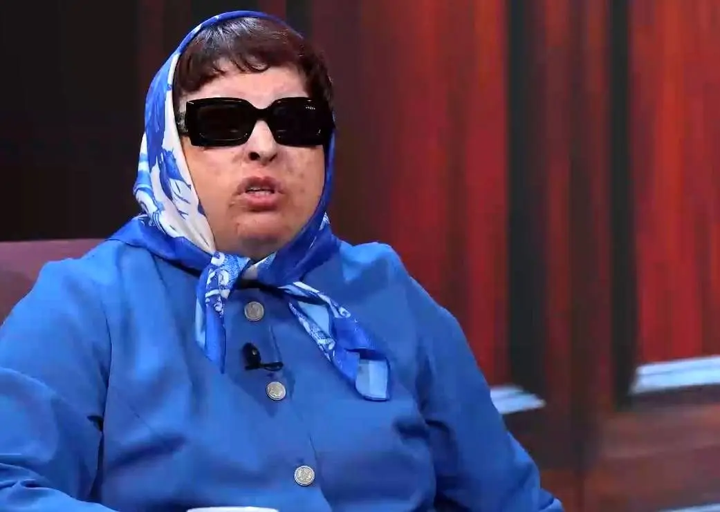 روایت تکان‌دهنده آمنه بهرامی از لحظه روبه‌رو شدن با اسیدپاش + ویدیو