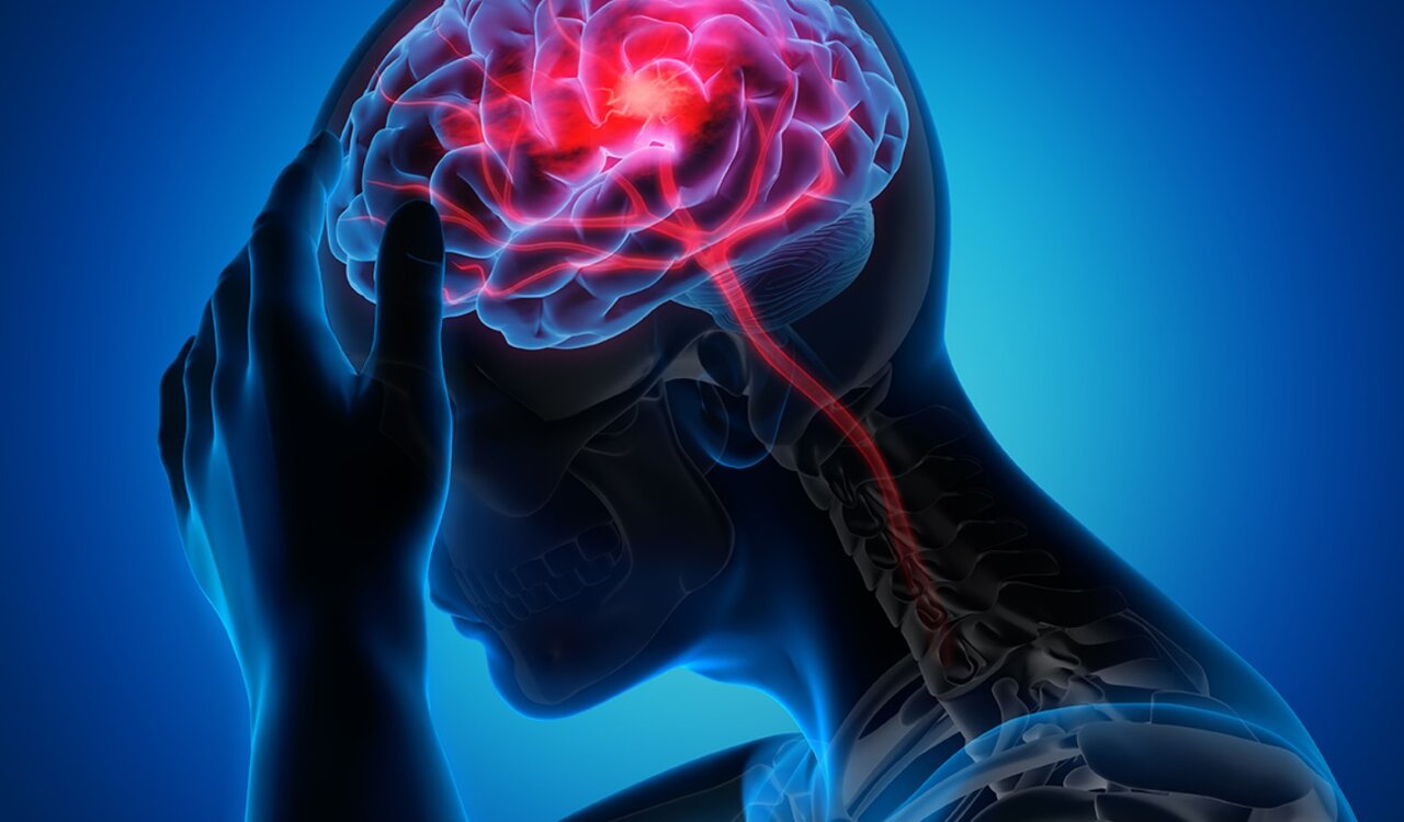 روزانه ۲۰۰ تهرانی دچار این عارضه می‌شوند