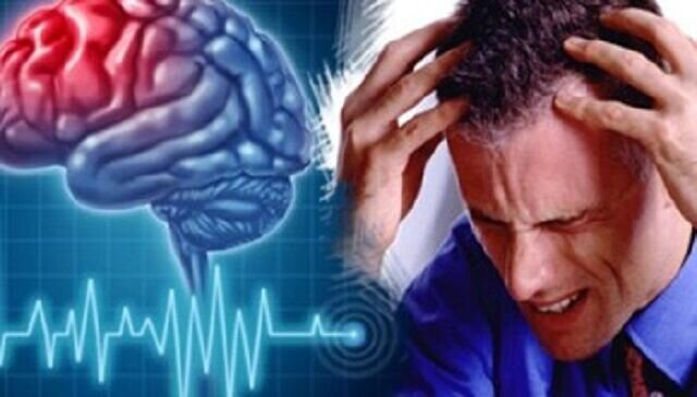 ۱۱ عامل بروز سکته مغزی را بشناسید ۱۱ عامل بروز سکته مغزی را بشناسید