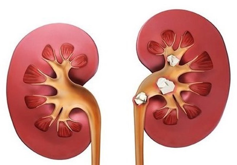 اخبار پزشکی| بیماری مزمن کلیه نهمین علت مرگ در جهان شد/ 80درصد صادرات دارویی ایران محصولات بیوتک است – تسنیم اخبار پزشکی| بیماری مزمن کلیه نهمین علت مرگ در جهان شد/ 80درصد صادرات دارویی ایران محصولات بیوتک است – تسنیم