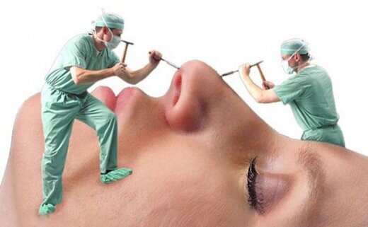 چرا شیادها در بازار جراحی زیبایی کاسبی شان پررونق است؟